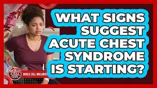 What Signs Suggest Acute Chest Syndrome Is Starting?