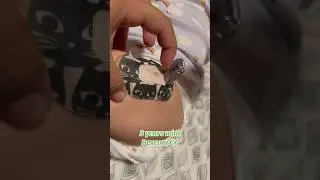 SHE&rsquo;S HAD A DEXCOM G6 FOR 3 YRS! #DIABETICTODDLER #DEXCOM #T1D