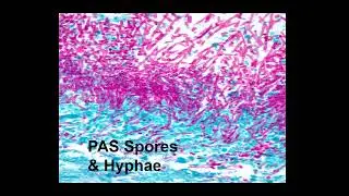 Learn It In a Minute - PAS, GMS, and Fungi