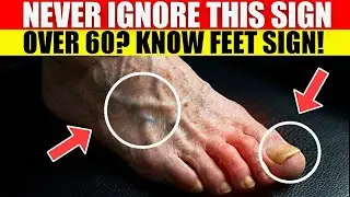 CRITICAL:3 changes in your feet right now are predicting deadly falls with terrifying accuracy.