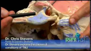 Temporomandibular Joint (TMJ) Treatments