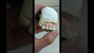 Implantes Dentales, Sonrisa Perfecta #odontolog&iacute;a #diente #originalcity