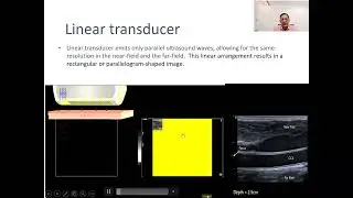 Introduction to Sonography: Types of Transducers