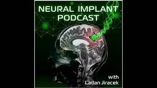 Paul Goode: Implantable Glucose Monitoring&mdash;and a Neural Interface Twist