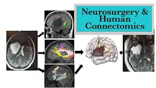 Neurosurgery & Human Connectomics - UNC Neurosurgery Winter Lecture Series