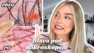 #5 VLOG | CO MI NAŠLI NA HLAVĚ POD MIKROSKOPEM?! 😳 + HONZOVO NAROZENINOVÉ PŘEKVAPENÍ! 🎉