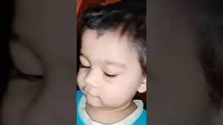 baby eye infection 😒#baby #viral #viralvideo#ytshorts #shorts #short#video #youtubeshorts #trending