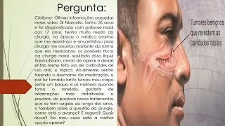 Tenho Pólipos Nasais | Como está o avanço do tratamento? | É seguro fazer a cirurgia?