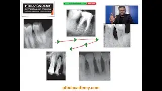 Endodontics | Quick Revision Class - NEET MDS 2021