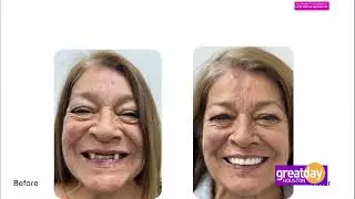 Elite Dental Specialists & Great Day Houston - 02.17.2025