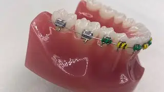 POKING WIRE At Home Solutions
