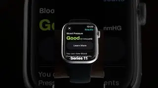Apple Watch Series 11 rumors 👀 #apple #applewatch #rumors