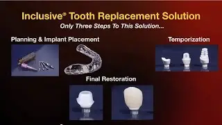 Clinical Benefits of the Inclusive&reg;Tooth Replacement Solution (Vol. 3, Issue 1)