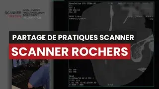 CT SCANNER ROCHERS - Partage de pratique