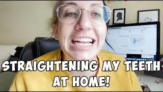 How I Straightened My Teeth At Home During the Pandemic