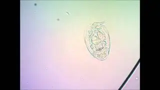Коловратка под микроскопом rotatoria under microscope