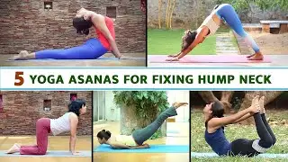 5 Yoga Asanas For Fixing Hump Neck | Yoga For Fixing Hump Neck | Exercise For Fixing Hump Neck |