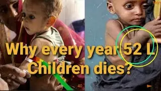 What are the major causes of death in children?