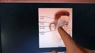 Paranasal Sinuses (Nasal Sphenoid Ethmoid Maxillary), Reg. GDPMLXMS