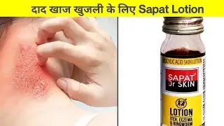 how to use sapat lotion | daad khaj khujli - ringworm hindi