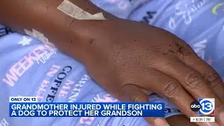Woman attacked by dog shares her recovery story