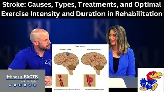 Stroke: Causes, Types, Treatments, and Optimal Exercise Intensity and Duration in Rehabilitation