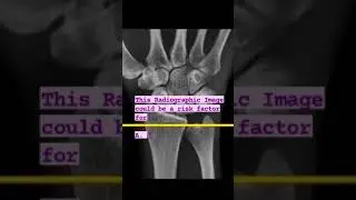 MCQ #orthopaedicprinciples #orthopaedics #neet #shorts #frcsorth #frcsc #fracs #usmle #usmlestep1
