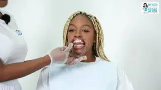Teeth Whitening Product FOCUS: Protective Blue Gel + Cotton Gauze