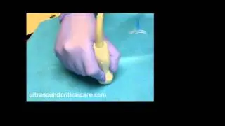 Rocking the transducer