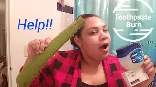 How to treat a toothpaste burn (products to use + step by step)