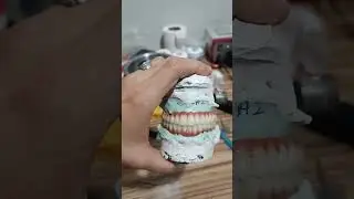 implant &uuml;st&uuml; porselen diş ( metal destekli porselen)