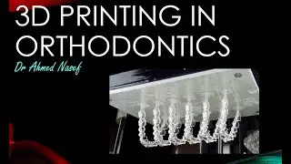 3D printing in Orthodontics  (Everything you need to know)