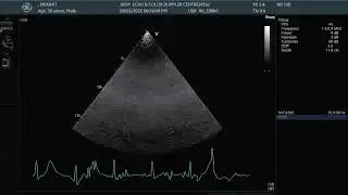 LIVE DEMO BASIC M MODE 2 D WITH Q nD A session 9 JAN 2022