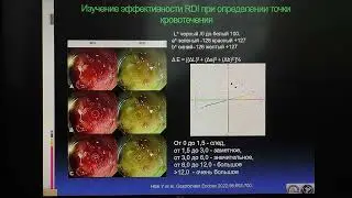 2024 03 27 EVIS X1 Водолеев АС RDI в профилактике и лечении Кровотечений при Эндоскопических Вмешате