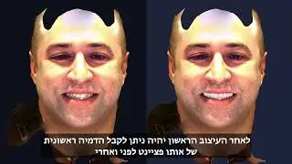 תכירו את APPLIFACE! מצלמת ה-3D המתקדמת בעולם - חייגו עכשיו 9170* ובואו להיות חלק מההצלחה!