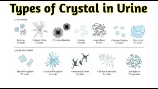 Types of crystals in urine