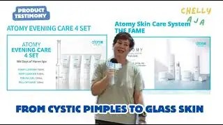 Product Testimony: From Cystic Pimples to Glass Skin with Atomy Skin Care 💆