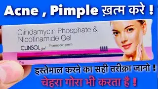 Clinsol Gel सच में काम करता है? 😱 Acne का 7 दिन में Result!#viralvideo 