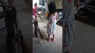 sturge weber syndrome warrior❤️❤️❤️ ang sipag magwalis little warrior mary pauline