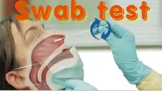 Swab Test Result.
