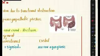 Congenital Megacolon