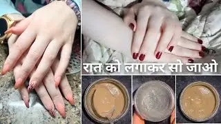 Fair Hand/Feet Overnight, Hand Wrinkles Removal Cream, DIY pack & cream for fair hand, 10 minute