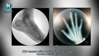 HCX-20/30D High Frequency Mobile C-arm X-ray System &ndash; Advanced Fluoroscopy & Radiography