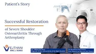 Patient's Story: Successful Restoration of Severe Shoulder Osteoarthritis Through Arthroplasty