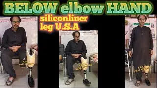 Below knee prosthesis imported silicon liner systam   #alps #siliconliner #artificialleg #leg #limb