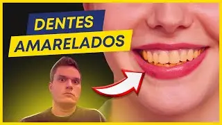 A VERDADE SOBRE DENTES AMARELADOS | CAUSAS E TRATAMENTO.
