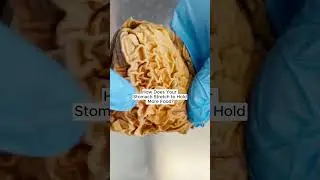 How Does Your Stomach Stretch to Hold More Food?
