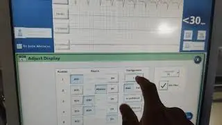 Paced ecg