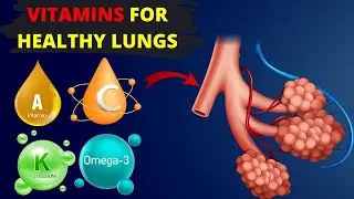 Best Foods for COPD Boost Your Lung Function Naturally
