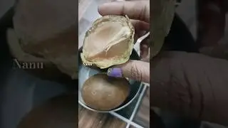 Sapodilla😀 health benefits 🫶 #shorts #youtube #health